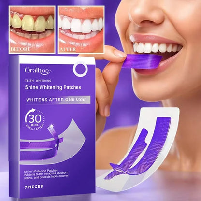 TEETH WHITENING STRIPS PACK OF 1 ( 7PARIS)