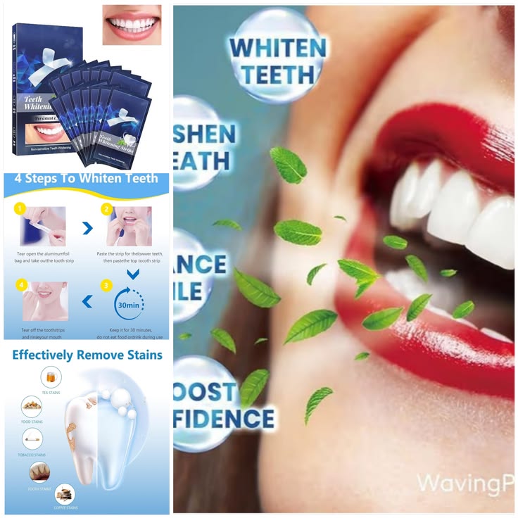 TEETH WHITENING STRIPS PACK OF 1 ( 7PARIS)